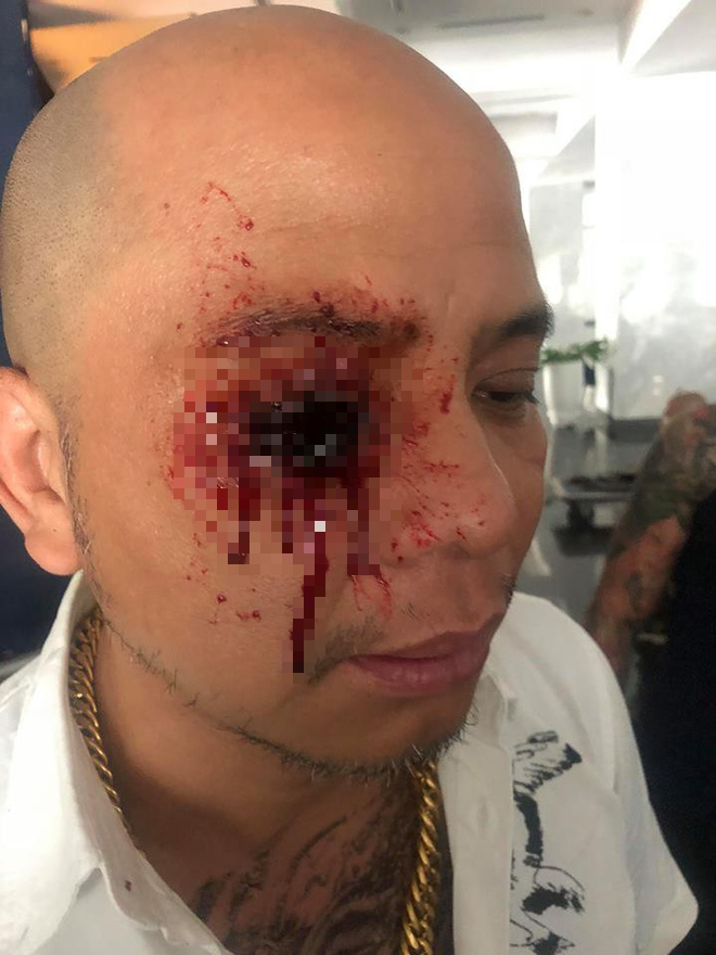 Người phán xử phần 2: Sợ hãi trước cảnh mù mắt của Thế Chột thời trẻ